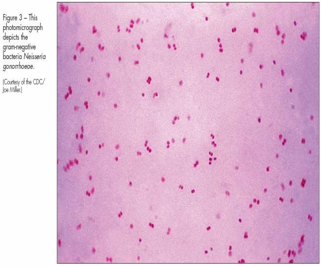 Neisseria gonorrhoeae Gram negatif, diplokoktur Oksidaz testi pozitifdir 35-37 C % 5 CO 2 li ortamda ve seçici