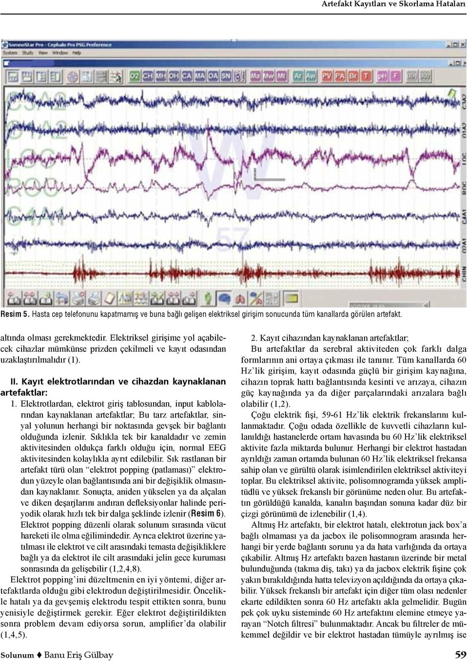 Elektrotlardan, elektrot giriş tablosundan, input kablolarından kaynaklanan artefaktlar; Bu tarz artefaktlar, sinyal yolunun herhangi bir noktasında gevşek bir bağlantı olduğunda izlenir.