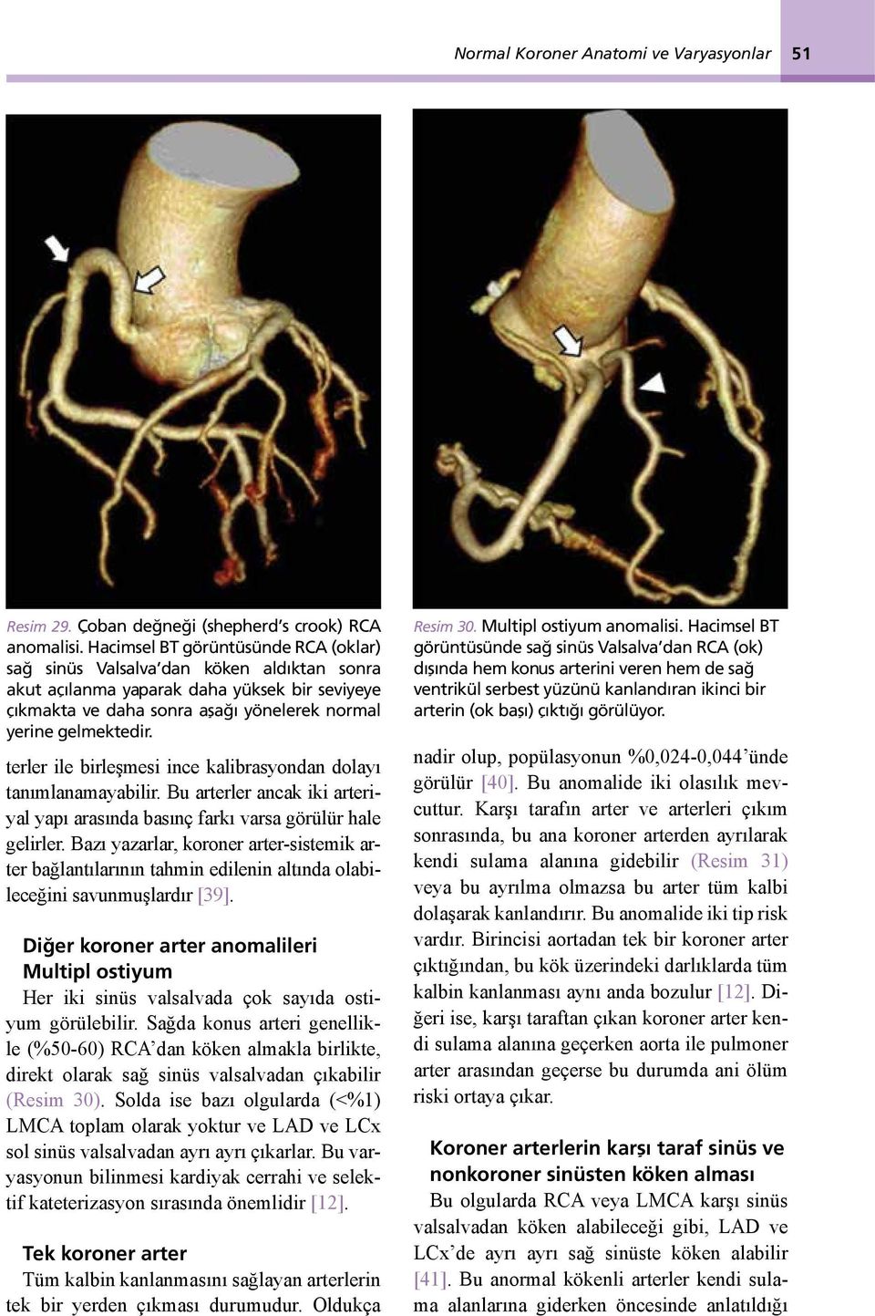 terler ile birleşmesi ince kalibrasyondan dolayı tanımlanamayabilir. Bu arterler ancak iki arteriyal yapı arasında basınç farkı varsa görülür hale gelirler.