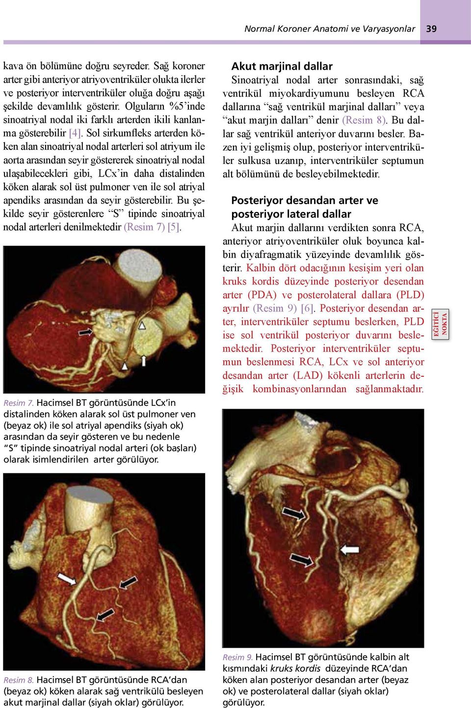 Olguların %5 inde sinoatriyal nodal iki farklı arterden ikili kanlanma gösterebilir [4].