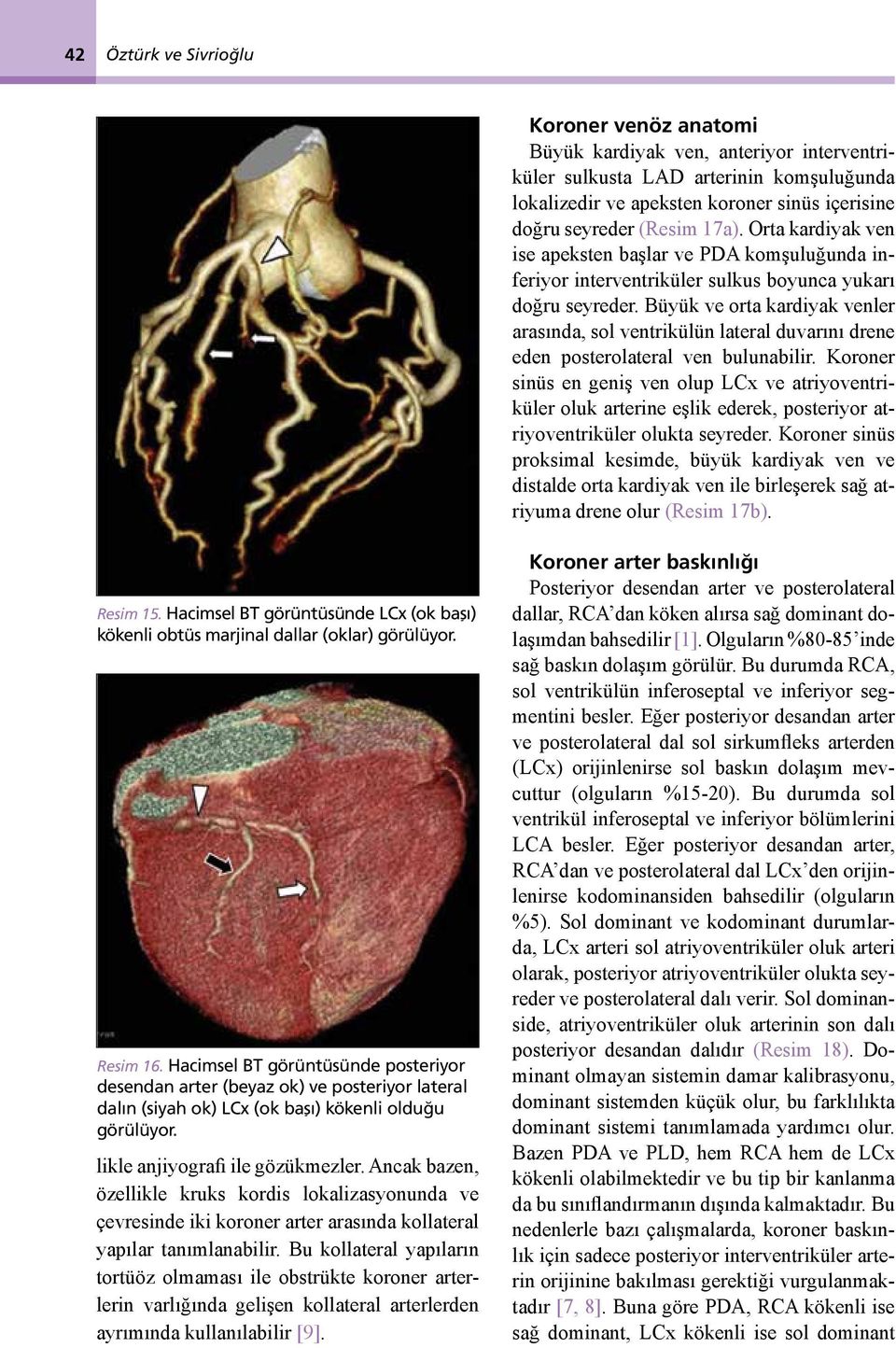 Büyük ve orta kardiyak venler arasında, sol ventrikülün lateral duvarını drene eden posterolateral ven bulunabilir.