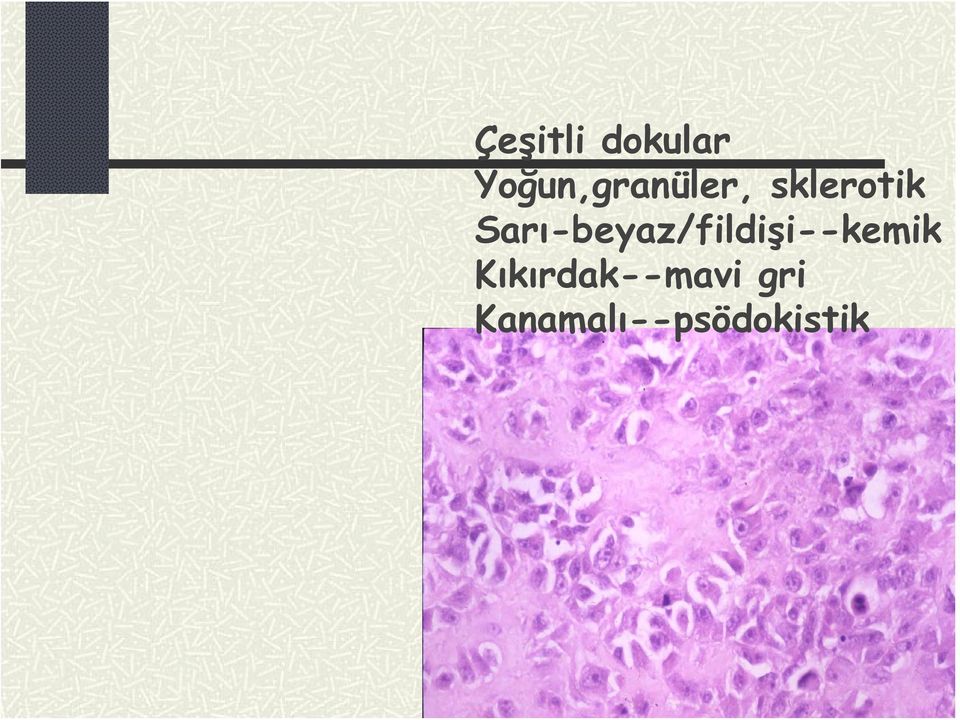 Sarı-beyaz/fildişi--kemik