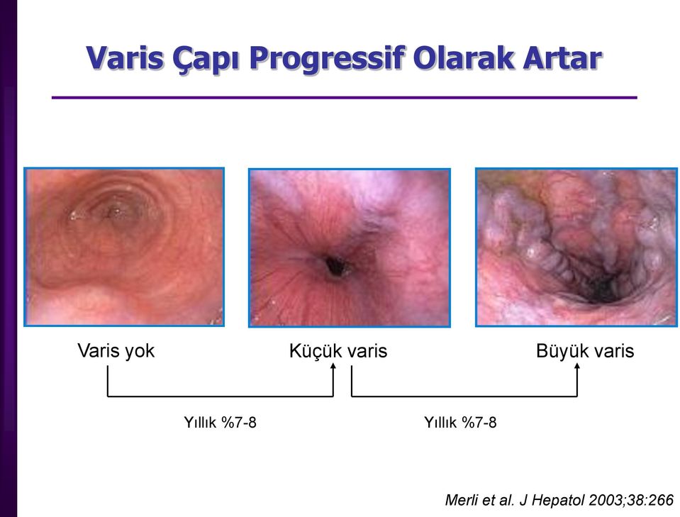 Büyük varis Yıllık %7-8 Yıllık