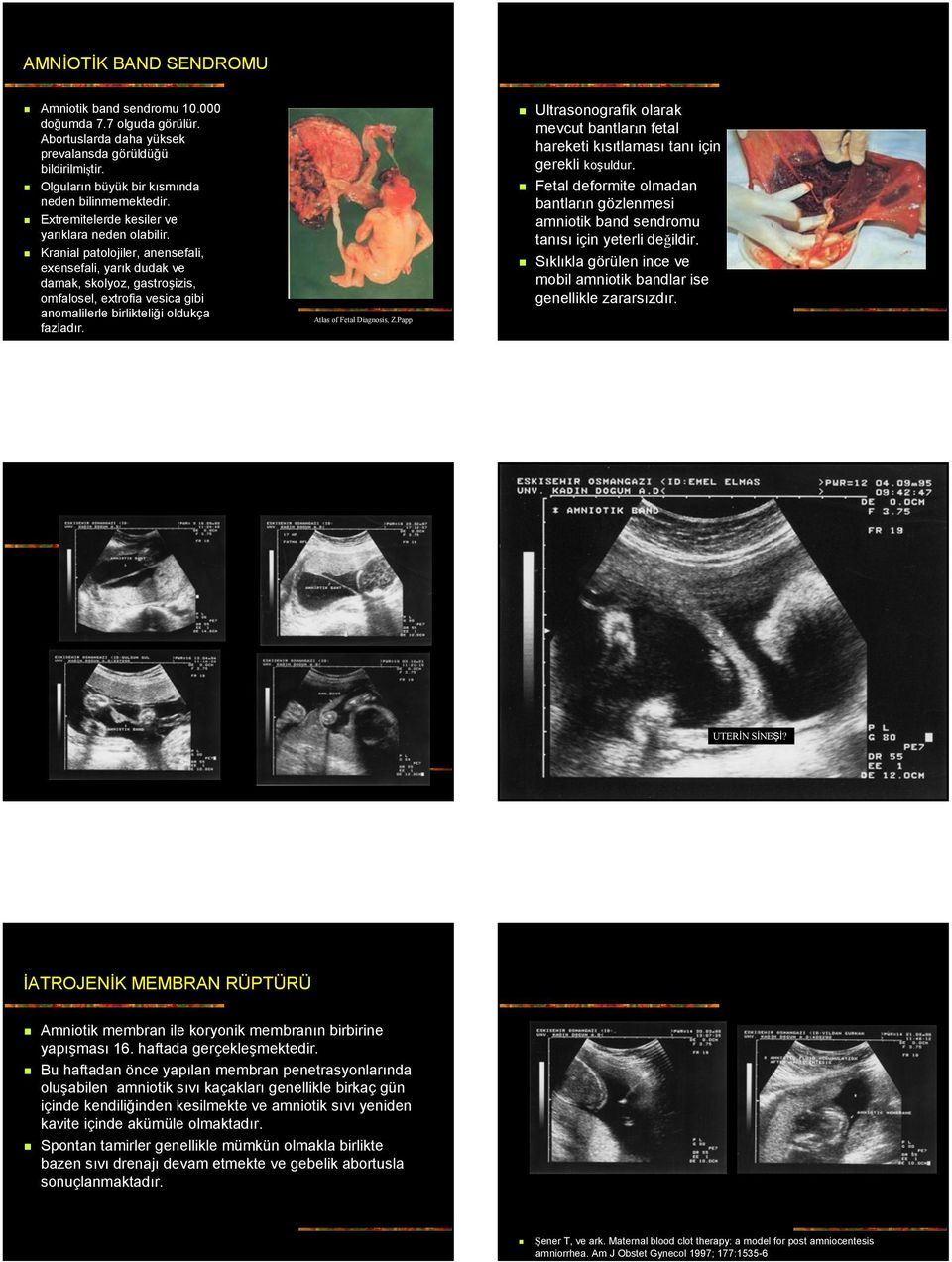 Kranial patolojiler, anensefali, exensefali, yarık dudak ve damak, skolyoz, gastroşizis, omfalosel, extrofia vesica gibi anomalilerle birlikteliği oldukça fazladır. Atlas of Fetal Diagnosis, Z.