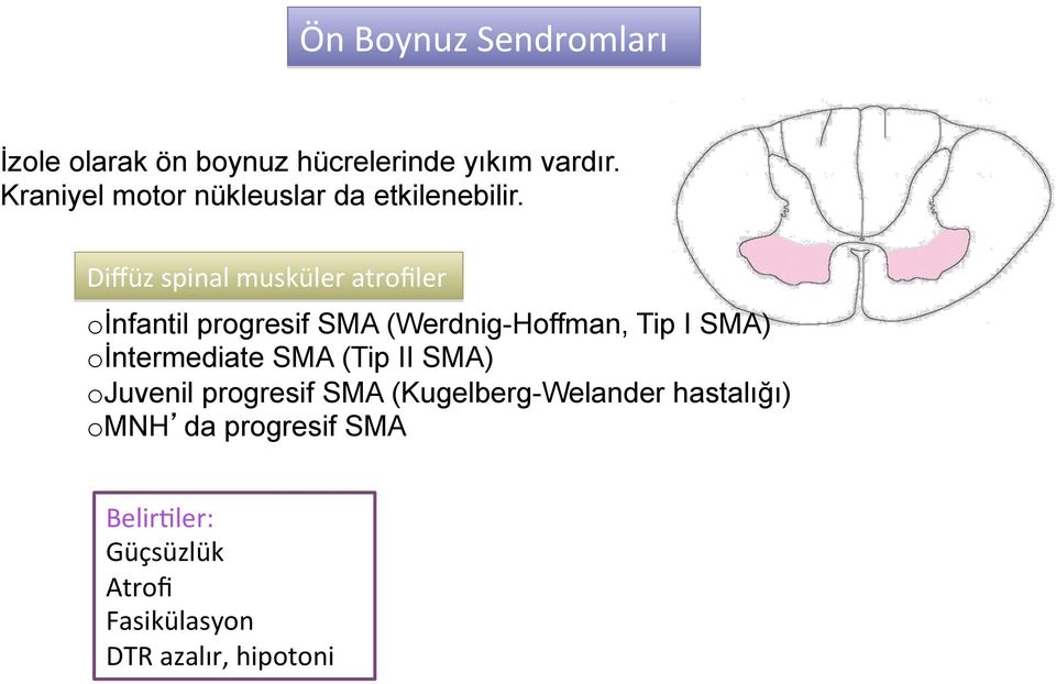 Diffüz spinal musküler atrofiler o İnfantil progresif SMA (Werdnig-Hoffman, Tip I SMA) o