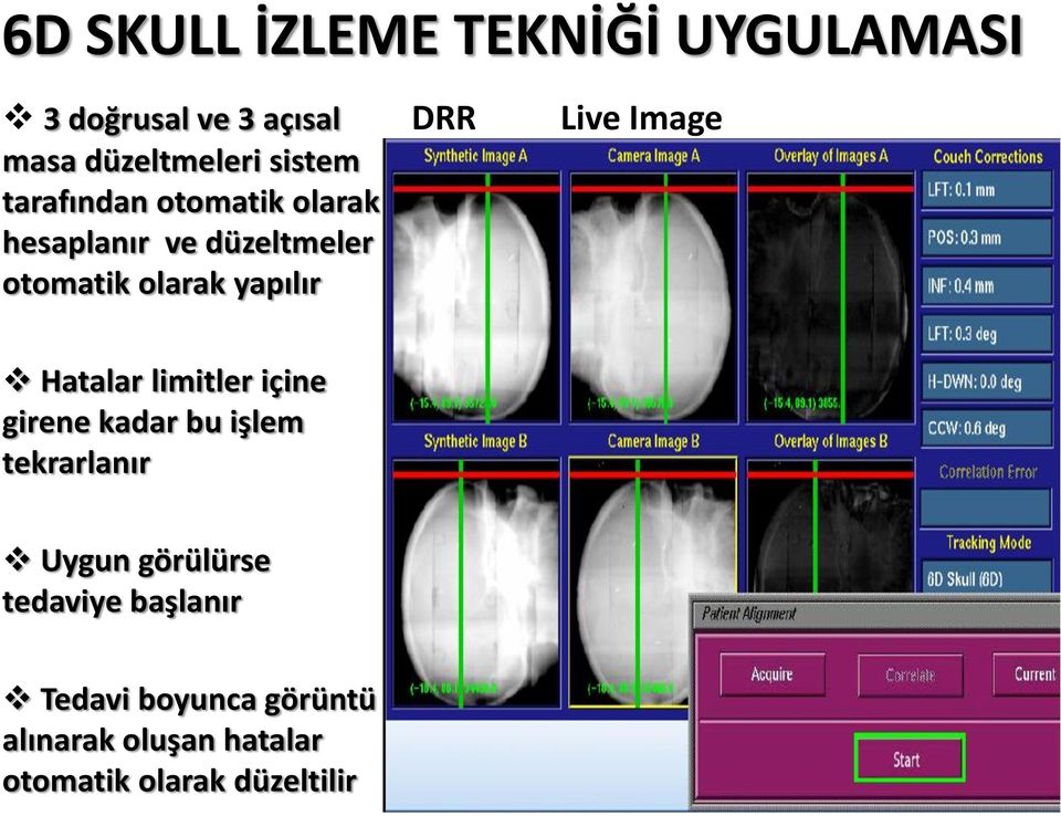 Live Image Hatalar limitler içine girene kadar bu işlem tekrarlanır Uygun görülürse