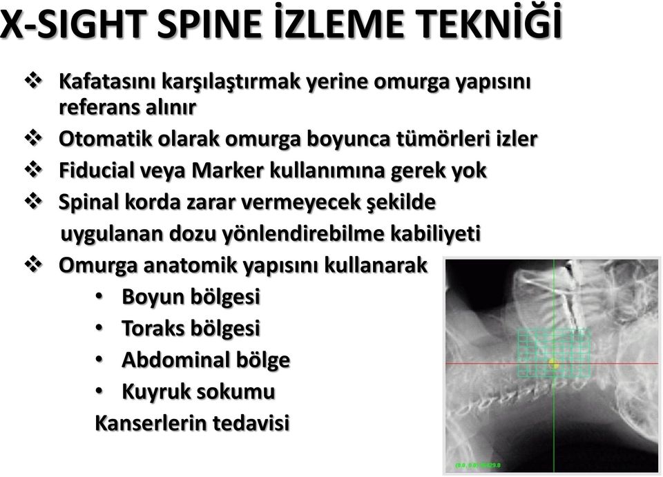 Spinal korda zarar vermeyecek şekilde uygulanan dozu yönlendirebilme kabiliyeti Omurga