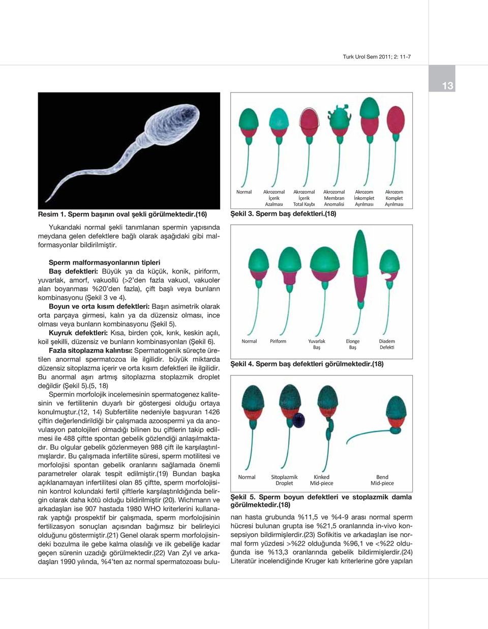 Normal Piriform Yuvarlak Elonge Şekil 4. Sperm baş defektleri görülmektedir.(18) Normal Sitoplazmik Droplet Kinked Mid-piece Diadem Defekti Bend Mid-piece Şekil 5.