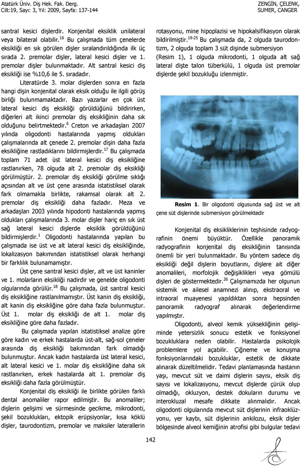 molar dişlerden sonra en fazla hangi dişin konjenital olarak eksik olduğu ile ilgili görüş birliği bulunmamaktadır.