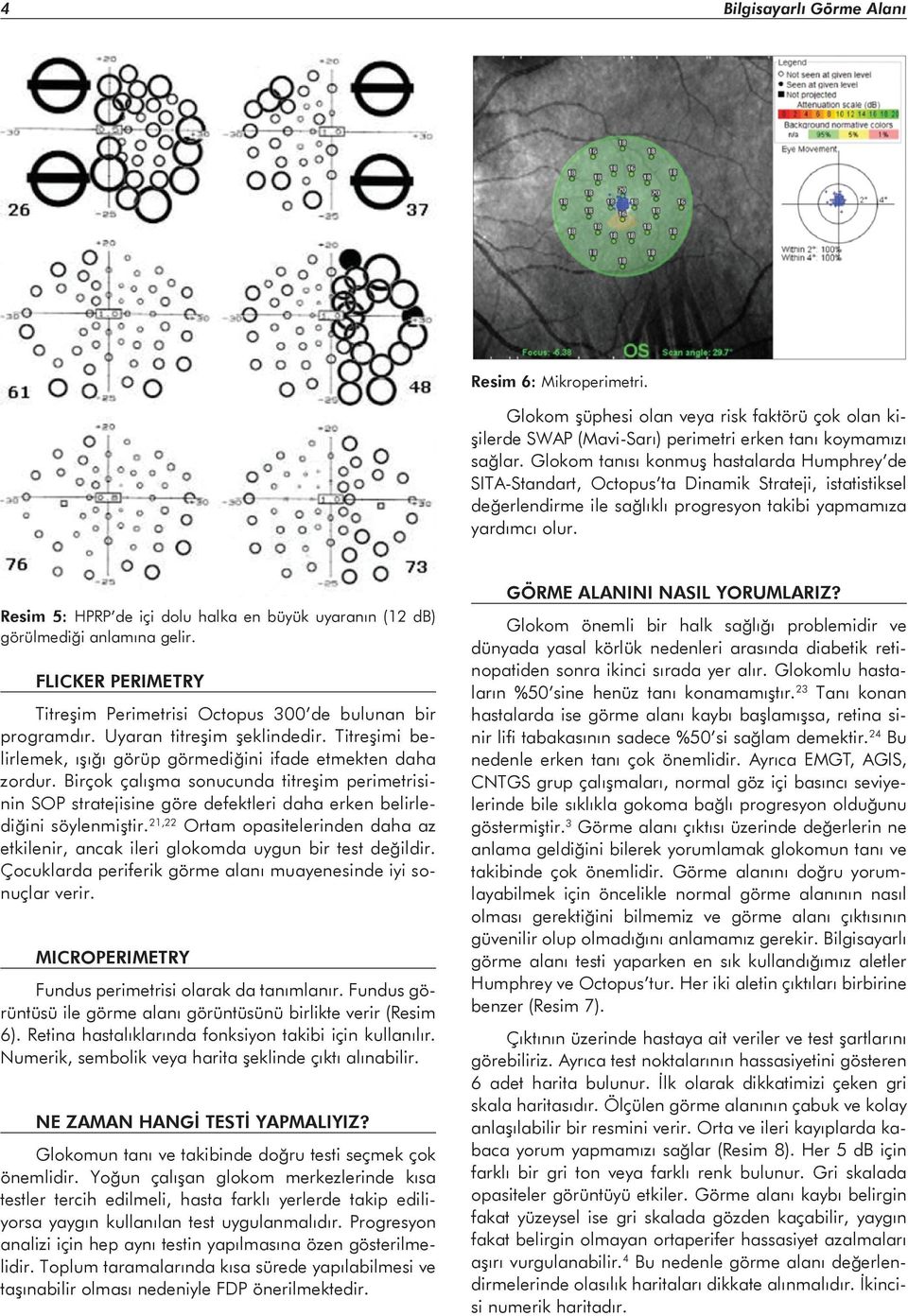 Resim 5: HPRP de içi dolu halka en büyük uyaranın (12 db) görülmediği anlamına gelir. FLICKER PERIMETRY Titreşim Perimetrisi Octopus 300 de bulunan bir programdır. Uyaran titreşim şeklindedir.