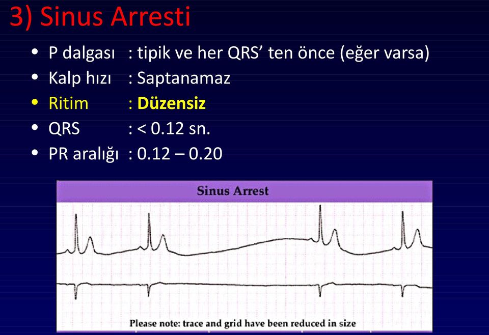 QRS ten önce (eğer varsa) :