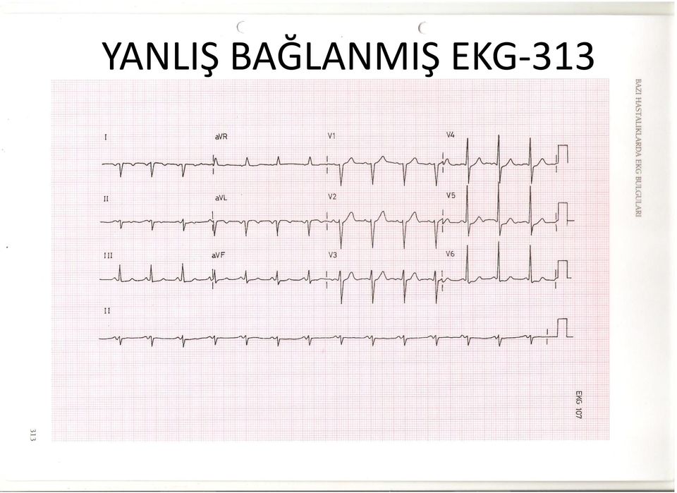 EKG-313