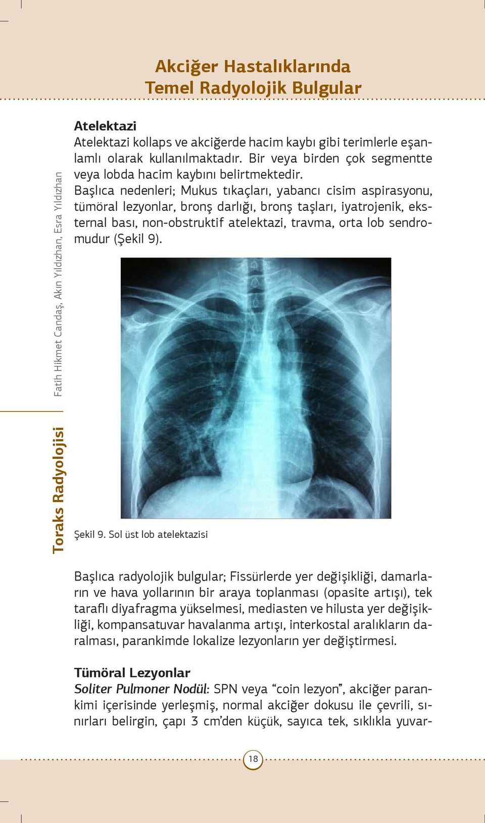 Başlıca nedenleri; Mukus tıkaçları, yabancı cisim aspirasyonu, tümöral lezyonlar, bronş darlığı, bronş taşları, iyatrojenik, eksternal bası, non-obstruktif atelektazi, travma, orta lob sendromudur