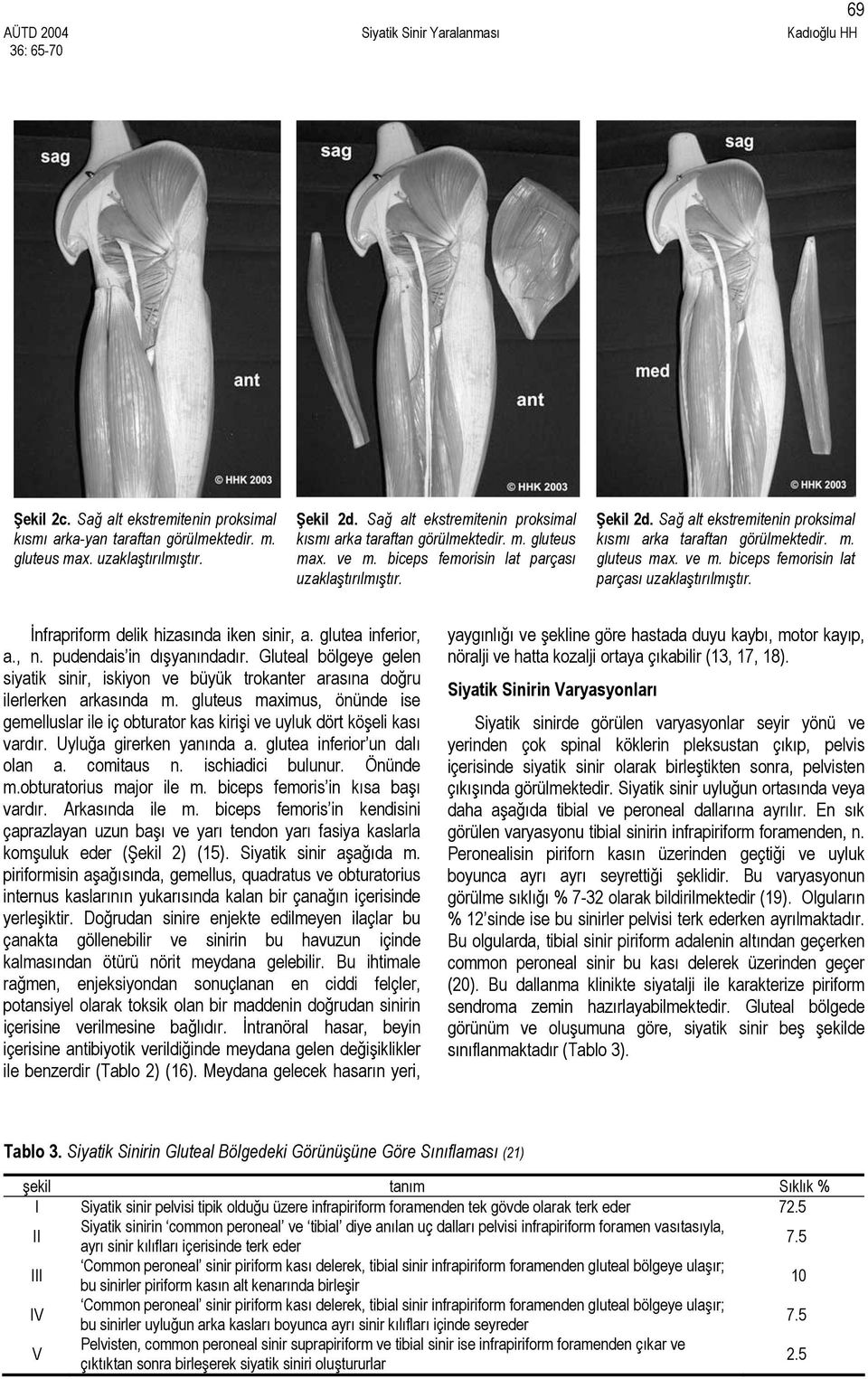 Sağ alt ekstremitenin proksimal kısmı arka taraftan görülmektedir. m. gluteus max. ve m. biceps femorisin lat parçası uzaklaştırılmıştır. İnfrapriform delik hizasında iken sinir, a.