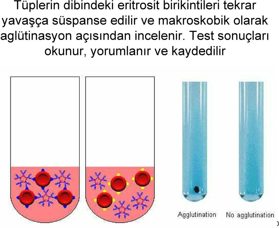 makroskobik olarak aglütinasyon açısından