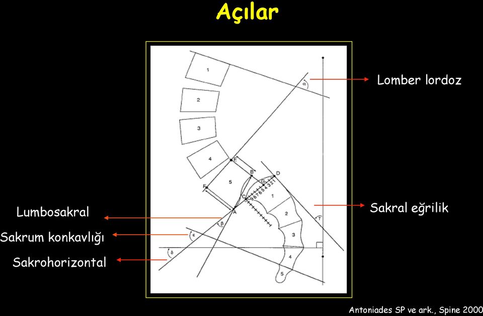 Sakrum konkavlığı