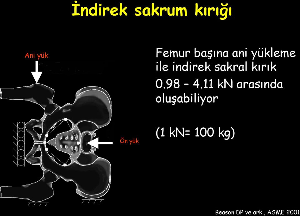 kırık 0.98 4.