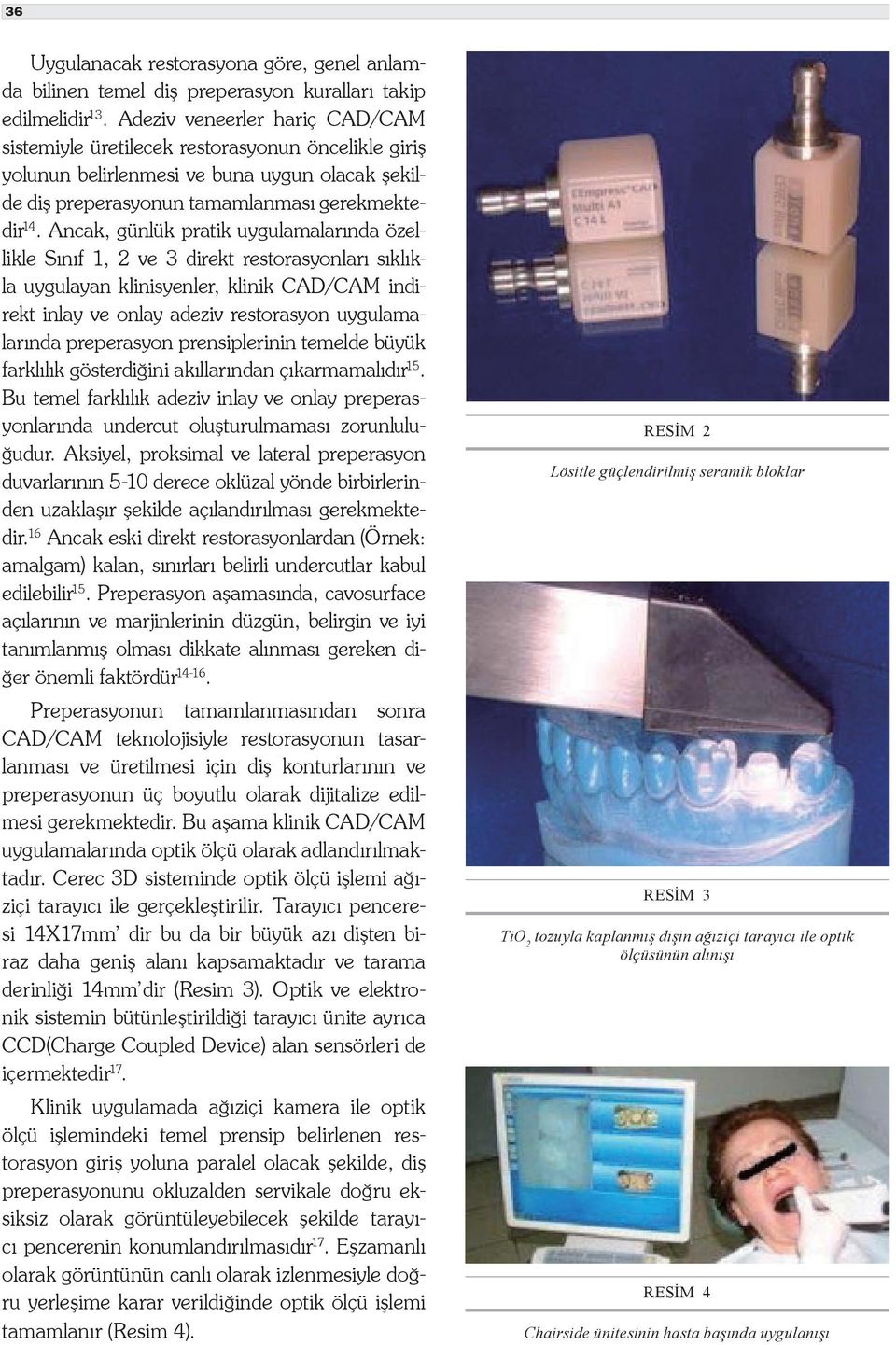 Ancak, günlük pratik uygulamalarında özellikle Sınıf 1, 2 ve 3 direkt restorasyonları sıklıkla uygulayan klinisyenler, klinik CAD/CAM indirekt inlay ve onlay adeziv restorasyon uygulamalarında