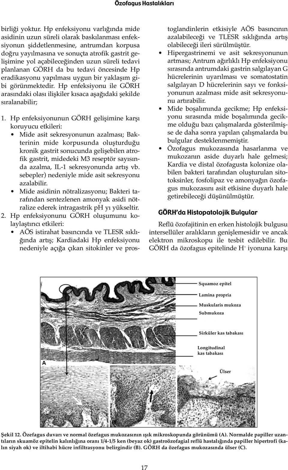 uzun süreli tedavi planlanan GÖRH da bu tedavi öncesinde Hp eradikasyonu yapılması uygun bir yaklaşım gibi görünmektedir.