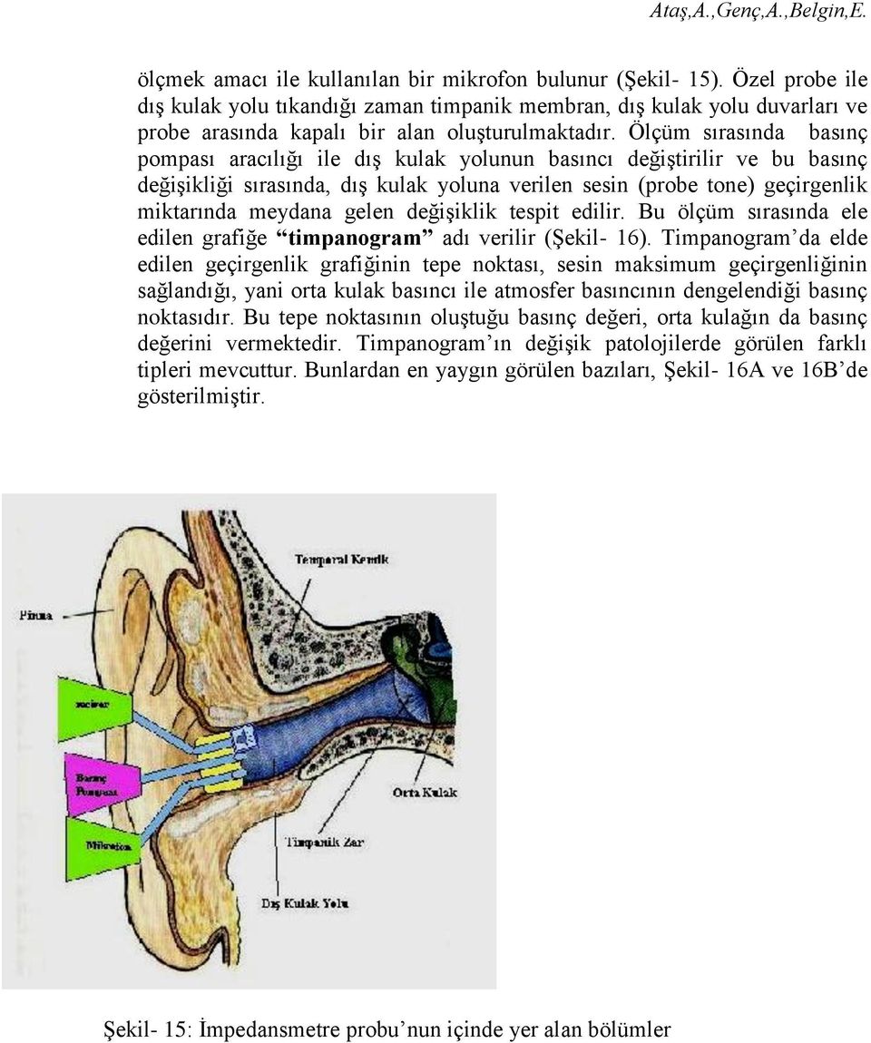 Ölçüm sırasında basınç pompası aracılığı ile dış kulak yolunun basıncı değiştirilir ve bu basınç değişikliği sırasında, dış kulak yoluna verilen sesin (probe tone) geçirgenlik miktarında meydana
