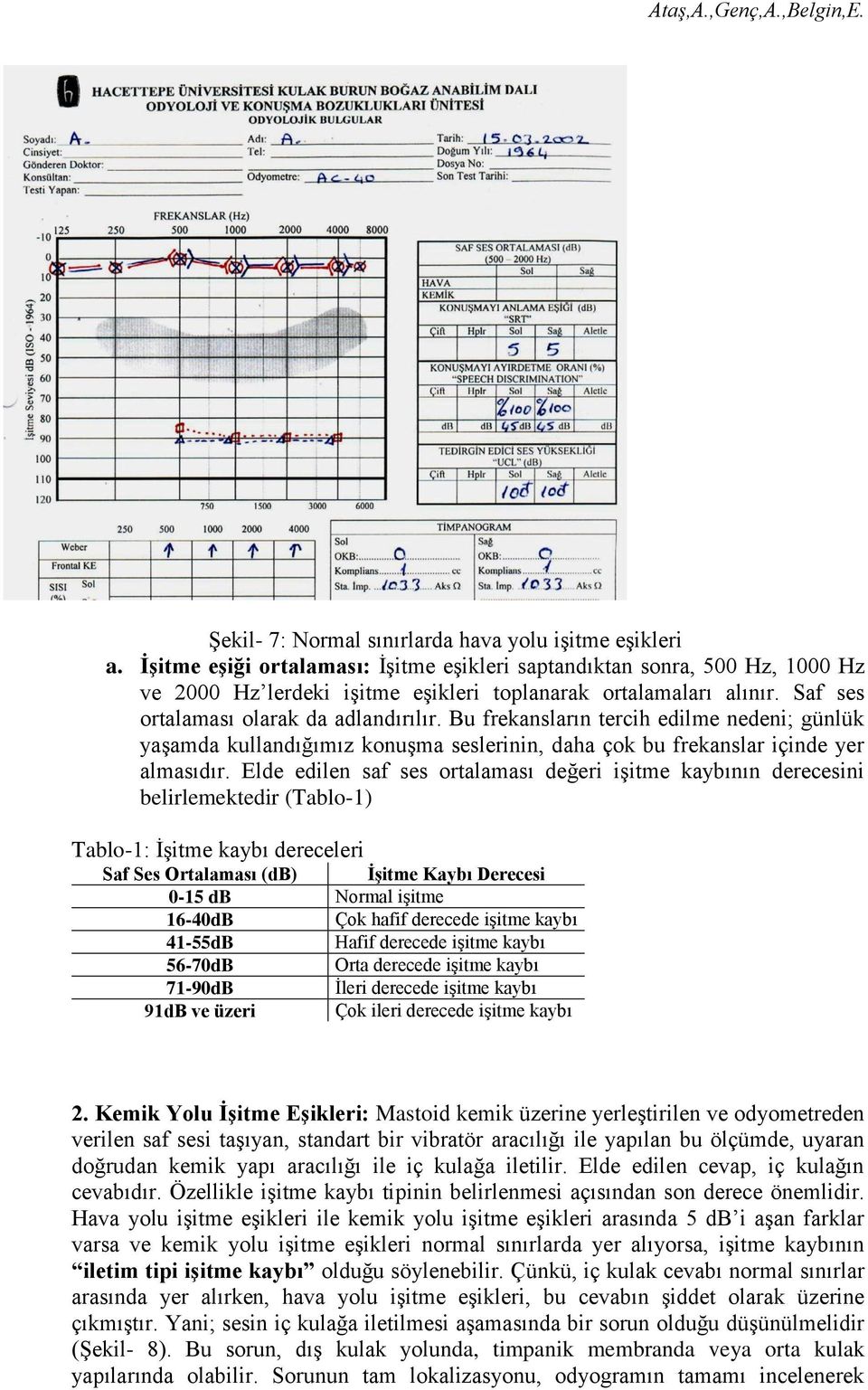 Elde edilen saf ses ortalaması değeri işitme kaybının derecesini belirlemektedir (Tablo-1) Tablo-1: İşitme kaybı dereceleri Saf Ses Ortalaması (db) İşitme Kaybı Derecesi 0-15 db Normal işitme 16-40dB
