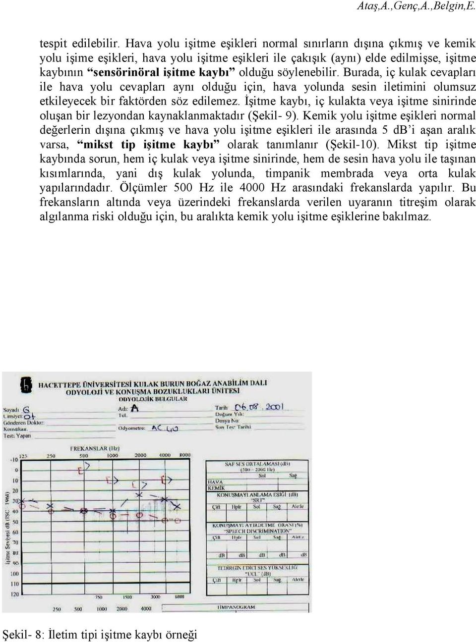 söylenebilir. Burada, iç kulak cevapları ile hava yolu cevapları aynı olduğu için, hava yolunda sesin iletimini olumsuz etkileyecek bir faktörden söz edilemez.