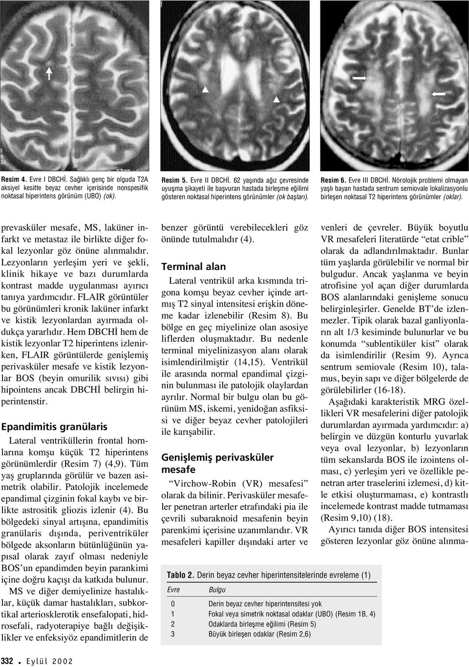 Nörolojik problemi olmayan yafll bayan hastada sentrum semiovale lokalizasyonlu birleflen noktasal T2 hiperintens görünümler (oklar).
