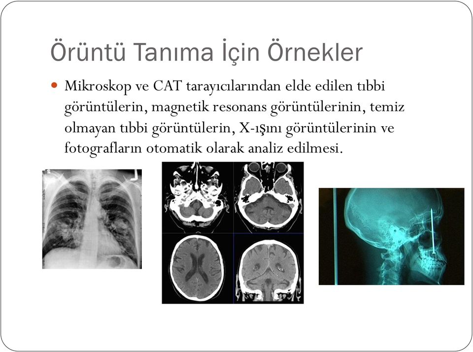 resonans görüntülerinin, temiz olmayan tıbbi görüntülerin,