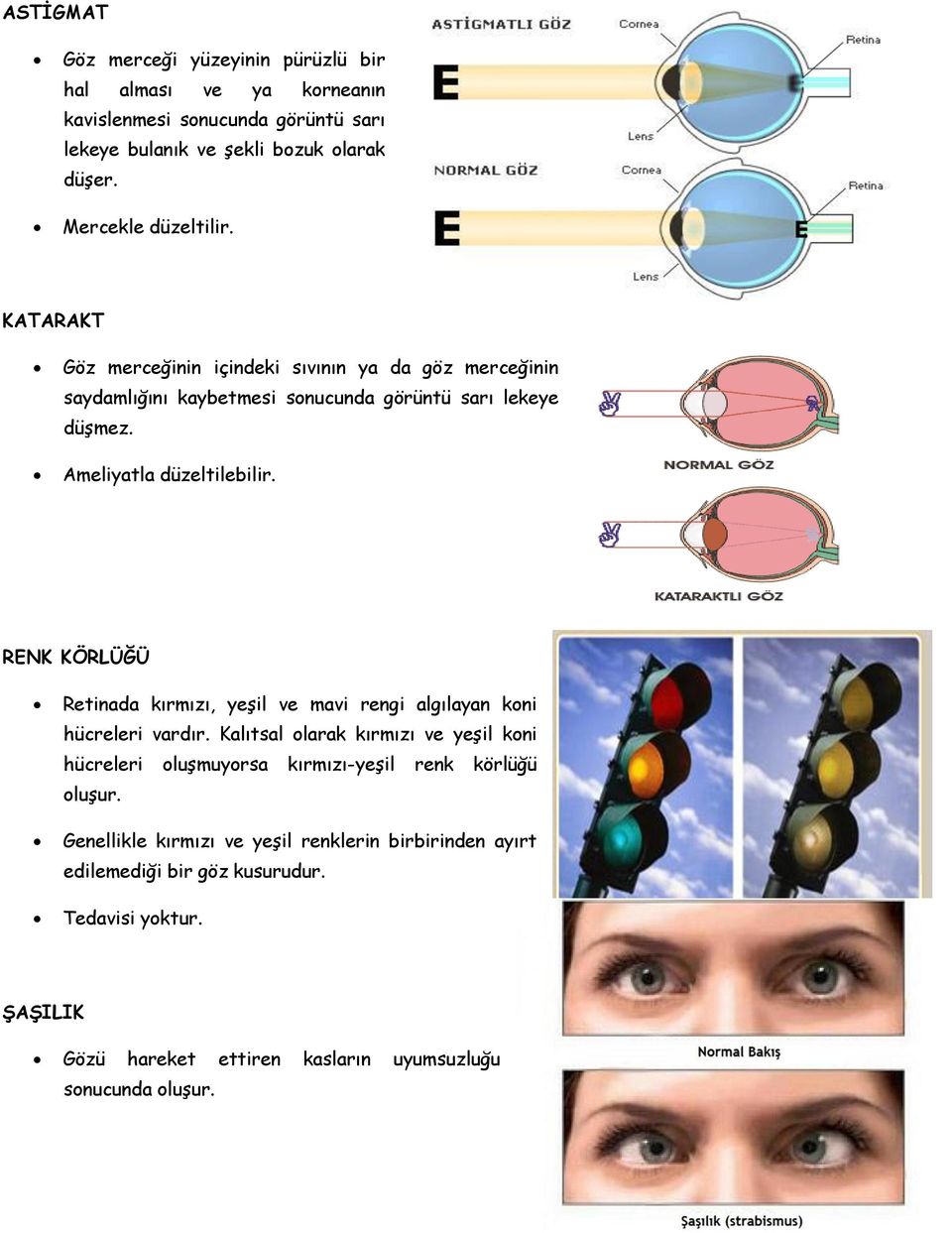 Ameliyatla düzeltilebilir. RENK KÖRLÜĞÜ Retinada kırmızı, yeşil ve mavi rengi algılayan koni hücreleri vardır.