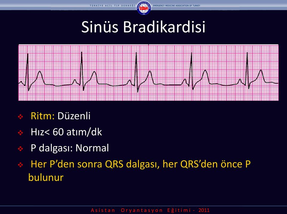 dalgası: Normal Her P den