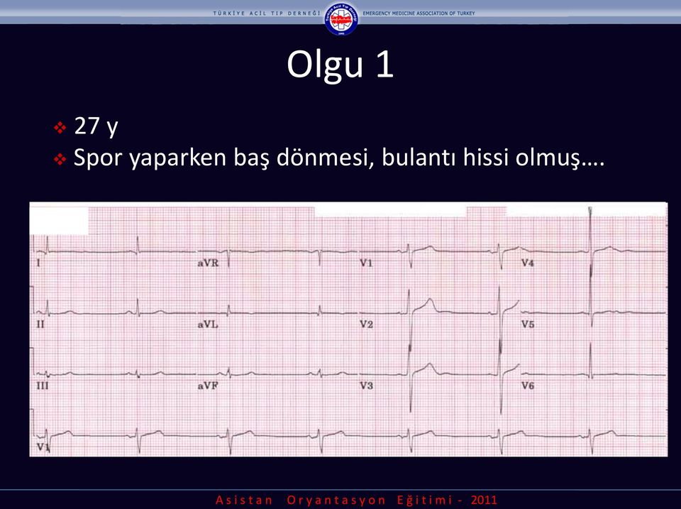 baş dönmesi,