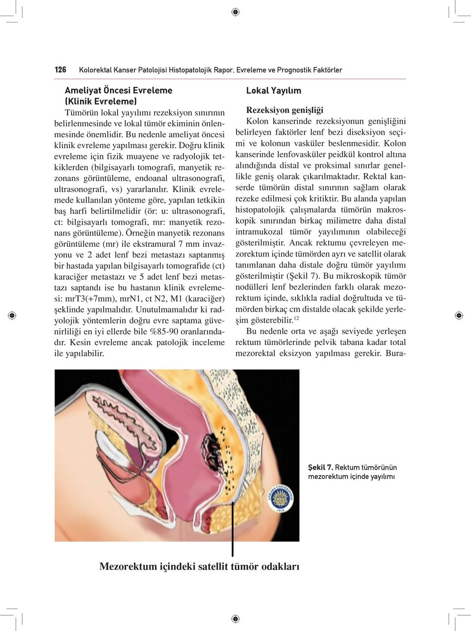 Doğru klinik evreleme için fizik muayene ve radyolojik tetkiklerden (bilgisayarlı tomografi, manyetik rezonans görüntüleme, endoanal ultrasonografi, ultrasonografi, vs) yararlanılır.