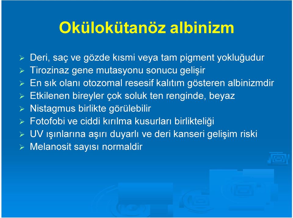 bireyler çok soluk ten renginde, beyaz Nistagmus birlikte görülebilir Fotofobi ve ciddi kırılma