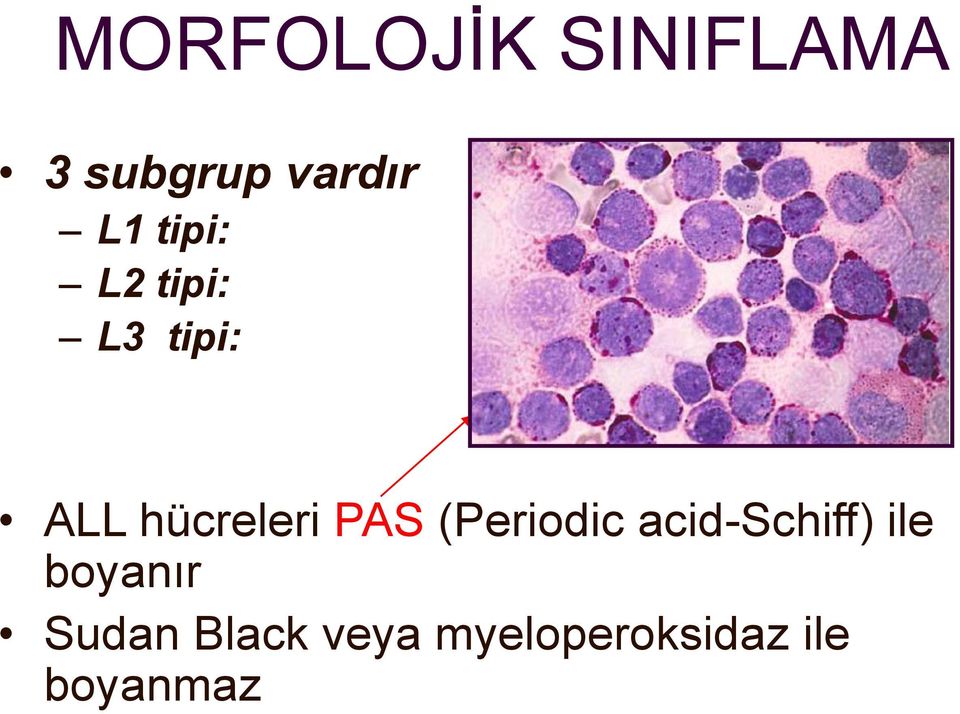 PAS (Periodic acid-schiff) ile boyanır