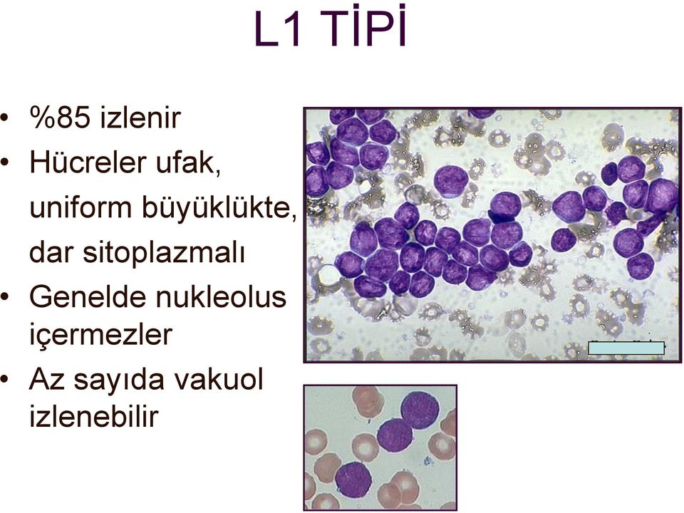 sitoplazmalı Genelde nukleolus