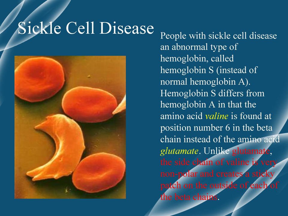 Hemoglobin S differs from hemoglobin A in that the amino acid valine is found at position number 6 in the