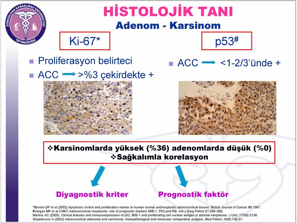 #Vargas MP et al (1997) Adrenocortical neoplasms: role of prognostic markers MIB-1, P53,and RB. Am.J Surg Pathol 21:556 562.