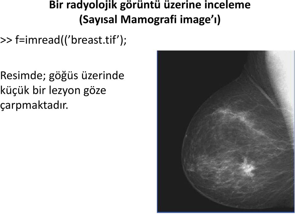 >> f=imread(( breast.