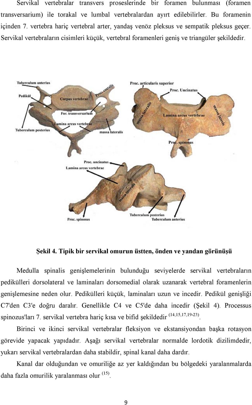 Tipik bir servikal omurun üstten, önden ve yandan görünüşü Medulla spinalis genişlemelerinin bulunduğu seviyelerde servikal vertebraların pedikülleri dorsolateral ve laminaları dorsomedial olarak