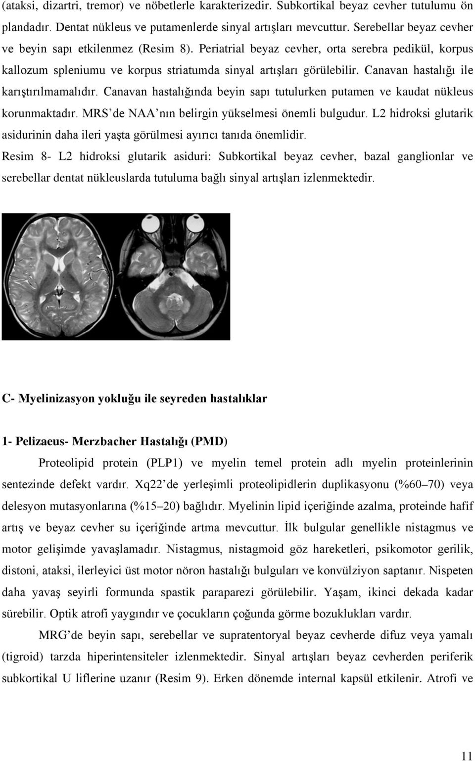 Canavan hastalığı ile karıştırılmamalıdır. Canavan hastalığında beyin sapı tutulurken putamen ve kaudat nükleus korunmaktadır. MRS de NAA nın belirgin yükselmesi önemli bulgudur.