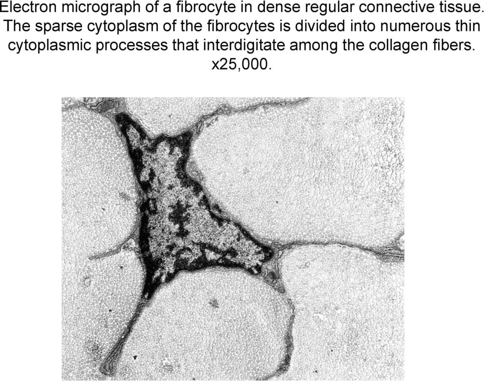 The sparse cytoplasm of the fibrocytes is divided