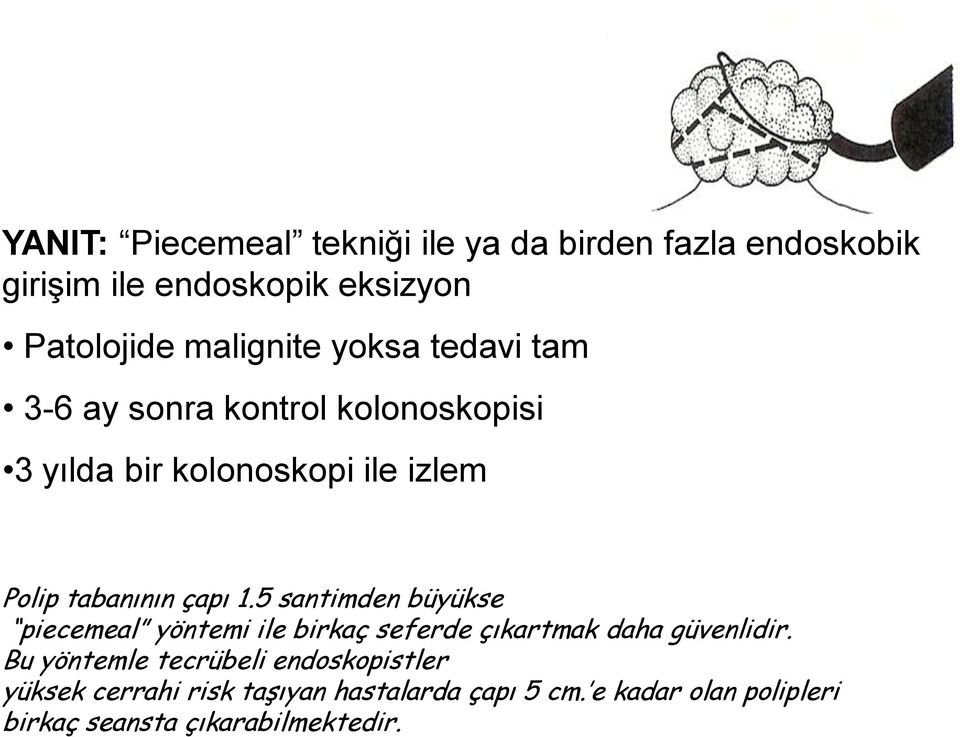 5 santimden büyükse piecemeal yöntemi ile birkaç seferde çıkartmak daha güvenlidir.