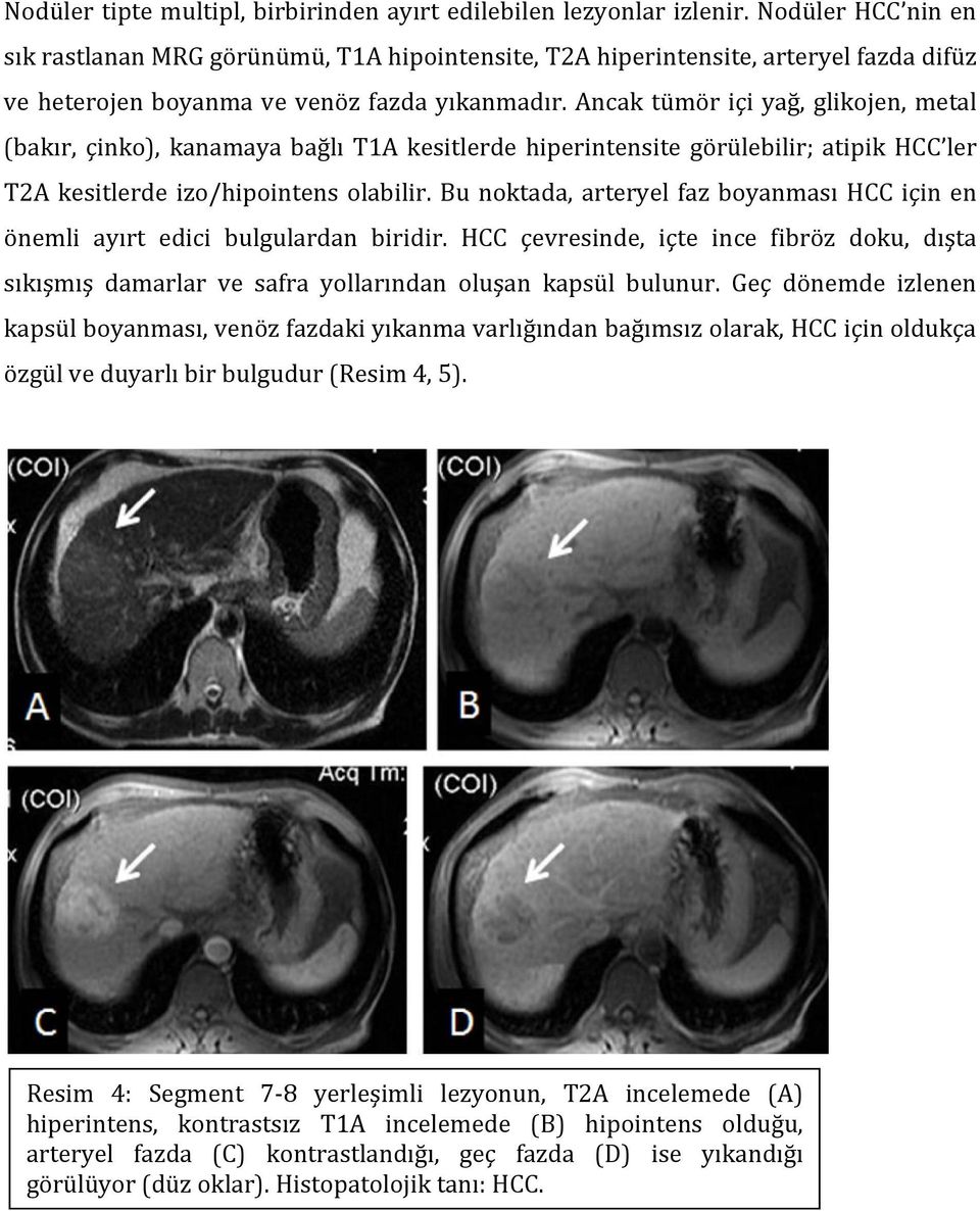 Ancak tümör içi yağ, glikojen, metal (bakır, çinko), kanamaya bağlı T1A kesitlerde hiperintensite görülebilir; atipik HCC ler T2A kesitlerde izo/hipointens olabilir.