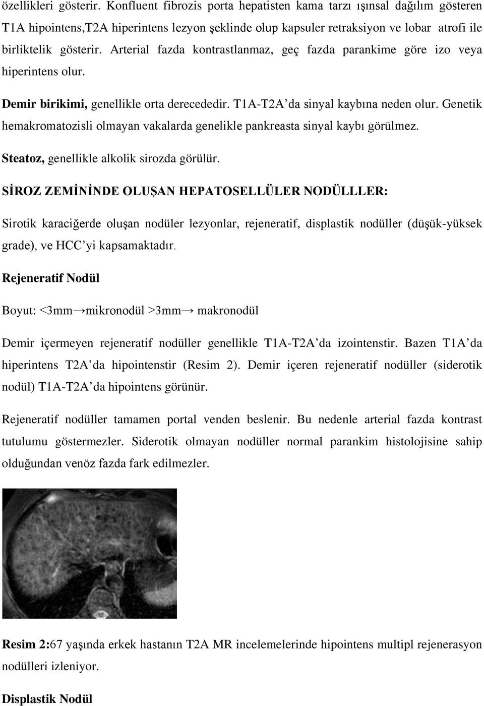 Arterial fazda kontrastlanmaz, geç fazda parankime göre izo veya hiperintens olur. Demir birikimi, genellikle orta derecededir. T1A-T2A da sinyal kaybına neden olur.