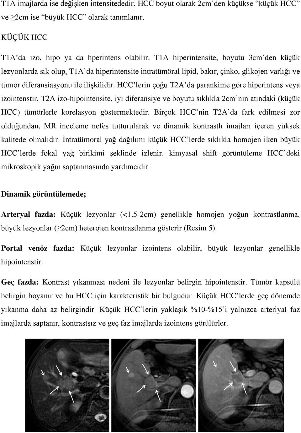 HCC lerin çoğu T2A da parankime göre hiperintens veya izointenstir. T2A izo-hipointensite, iyi diferansiye ve boyutu sıklıkla 2cm nin atındaki (küçük HCC) tümörlerle korelasyon göstermektedir.