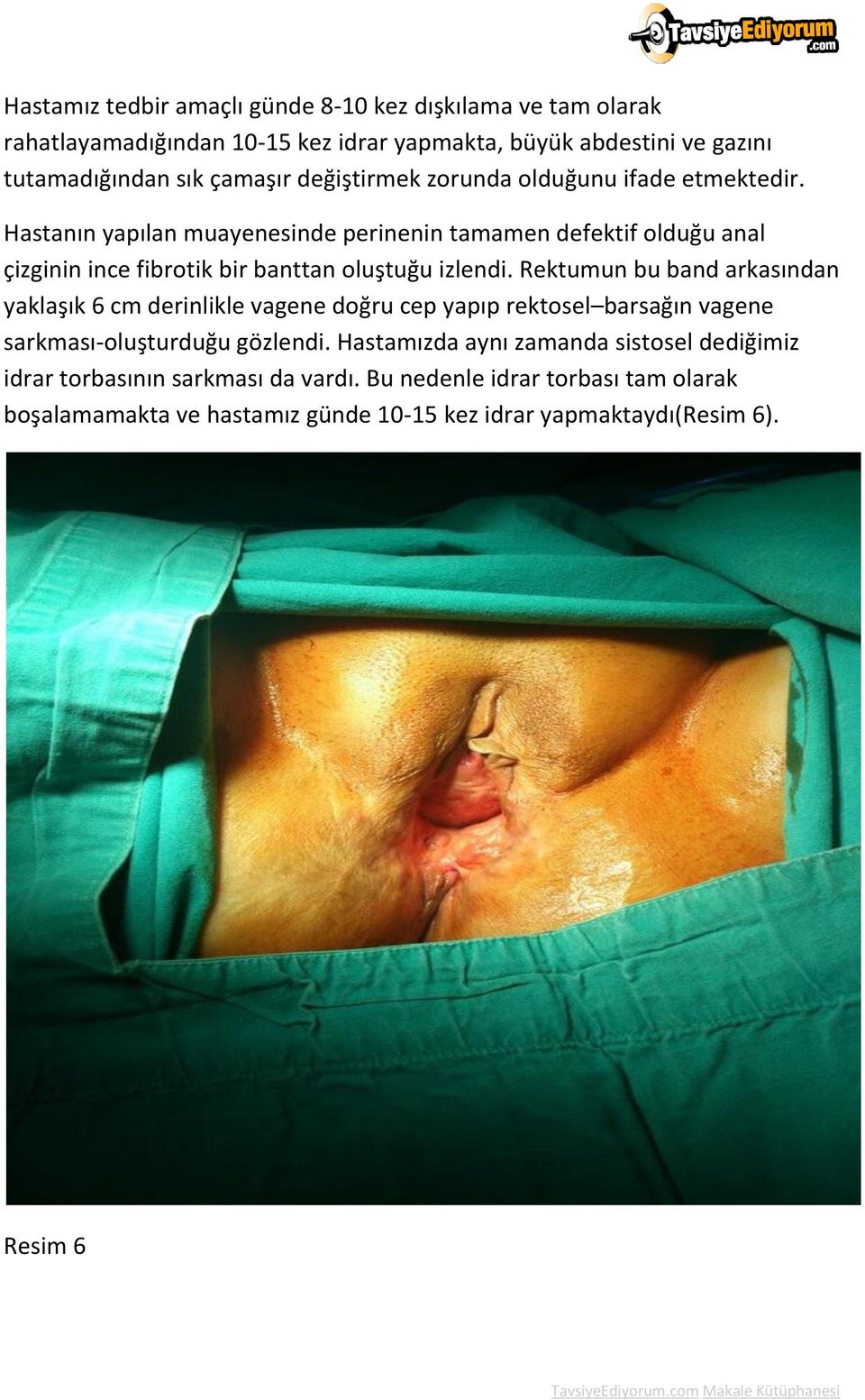 Hastanın yapılan muayenesinde perinenin tamamen defektif olduğu anal çizginin ince fibrotik bir banttan oluştuğu izlendi.