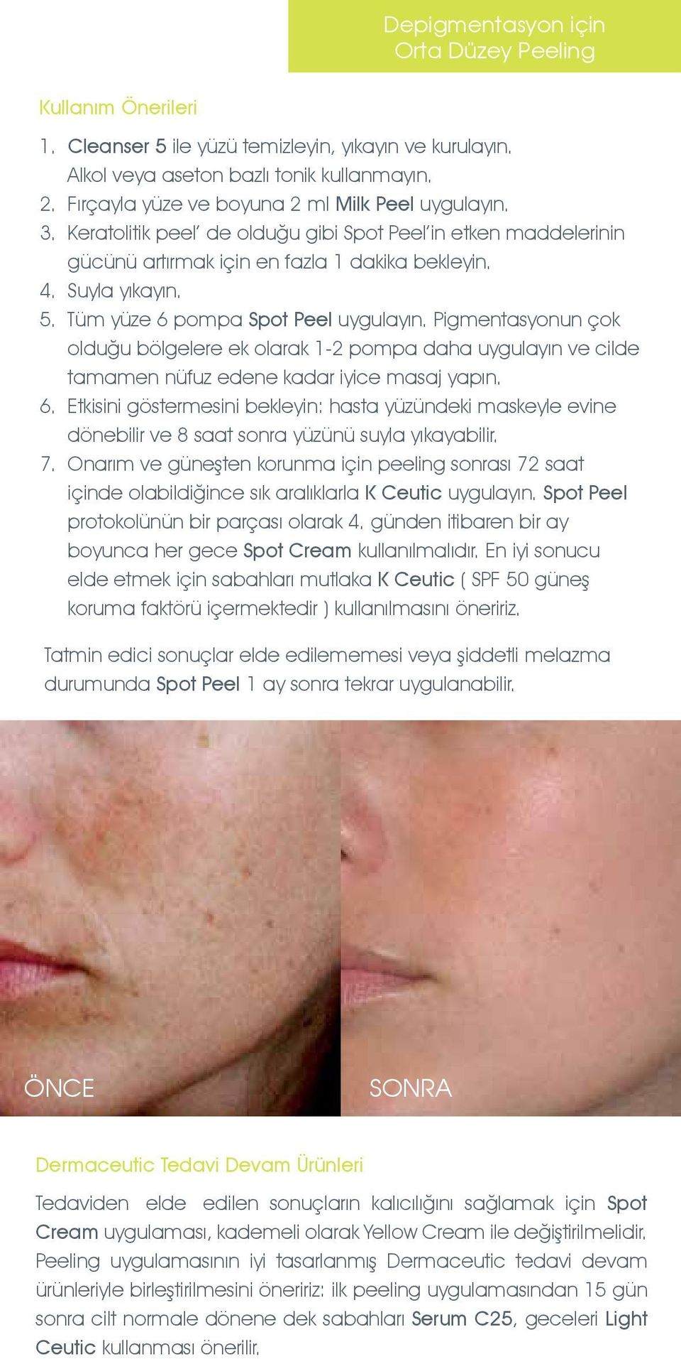 Tüm yüze 6 pompa Spot Peel uygulayın. Pigmentasyonun çok olduğu bölgelere ek olarak 1-2 pompa daha uygulayın ve cilde tamamen nüfuz edene kadar iyice masaj yapın. 6. Etkisini göstermesini bekleyin: hasta yüzündeki maskeyle evine dönebilir ve 8 saat sonra yüzünü suyla yıkayabilir.