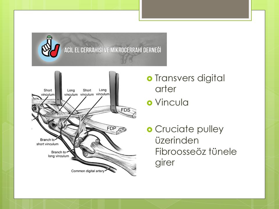 Cruciate pulley