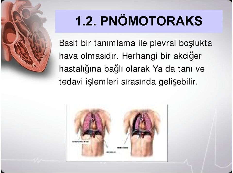 Herhangi bir akciğer hastalığına bağlı