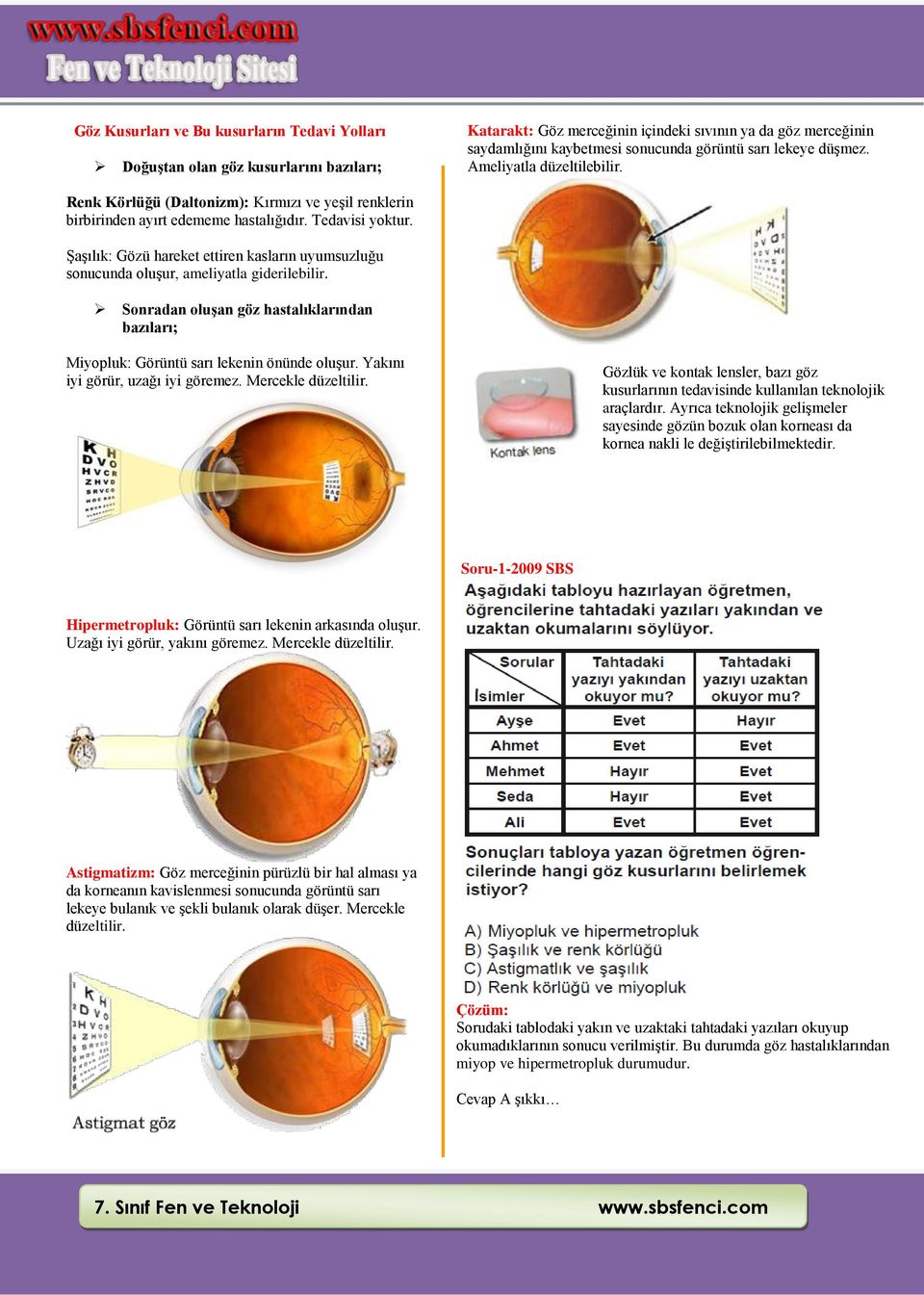 Şaşılık: Gözü hareket ettiren kasların uyumsuzluğu sonucunda oluşur, ameliyatla giderilebilir. Sonradan oluşan göz hastalıklarından bazıları; Miyopluk: Görüntü sarı lekenin önünde oluşur.